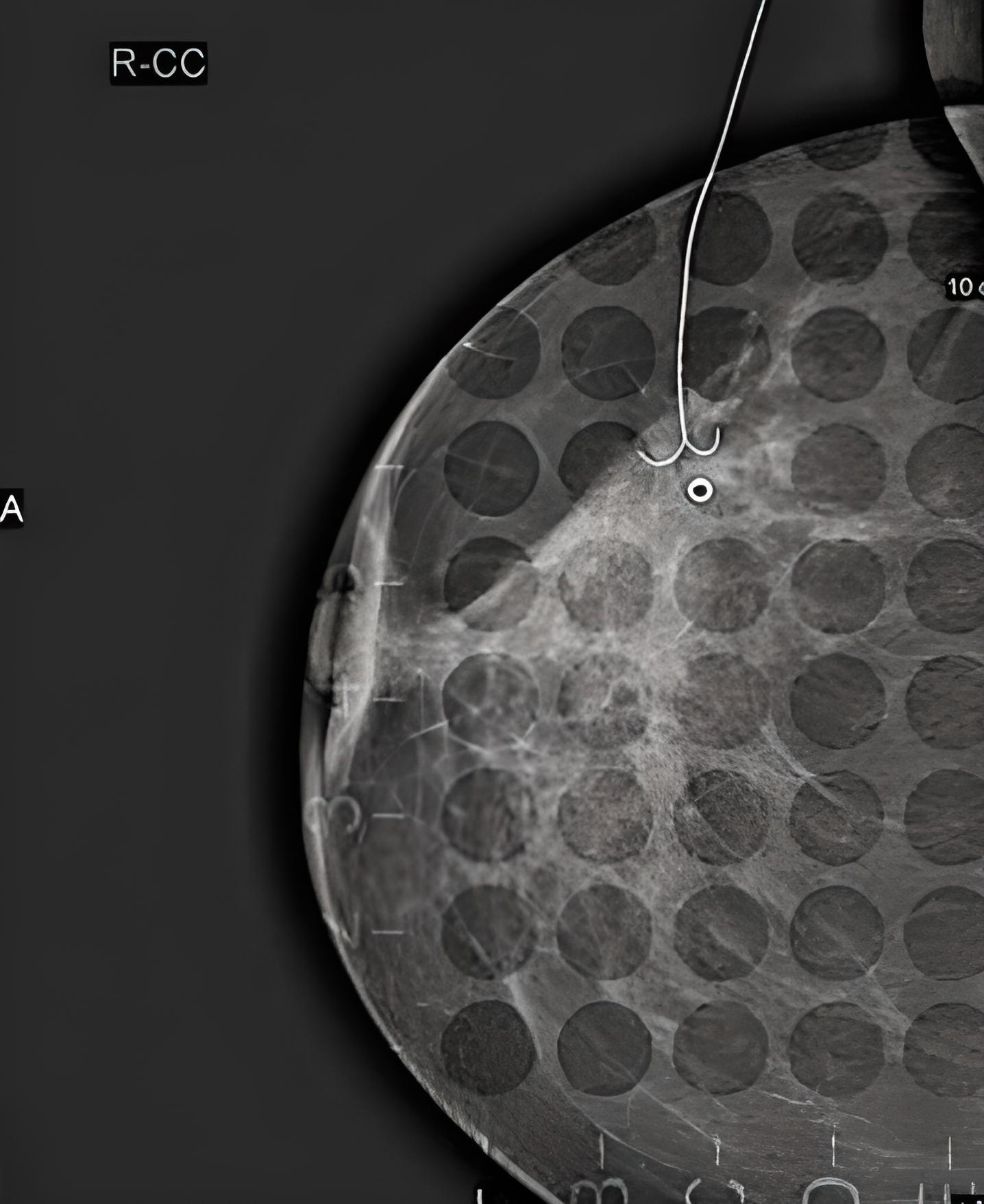 Mammographie Radiologie Korbach